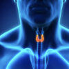 Hypothyroidism – Appropriate testing required
